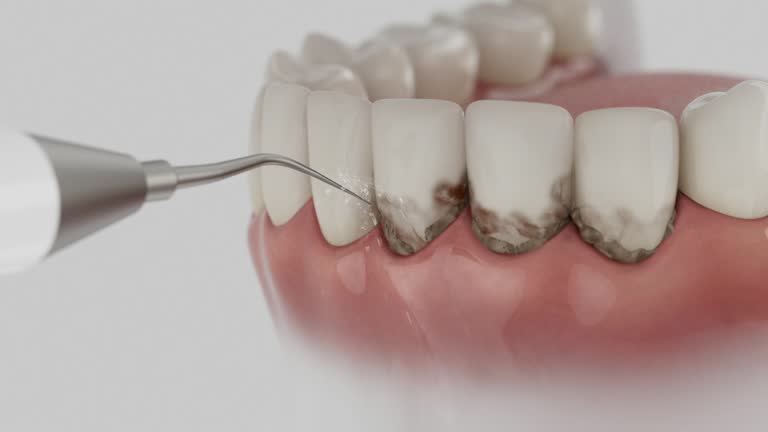 Reliable Dental contractor in Perrysburg, OH by Dentist Open Now